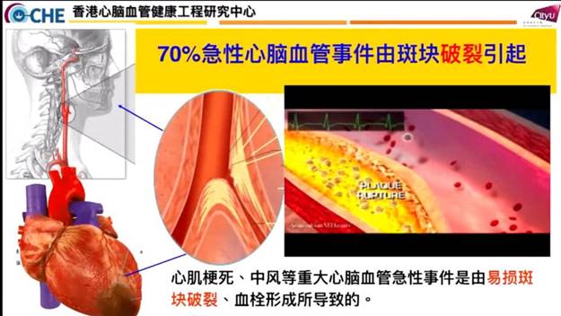 2022.11.21OE欧亿官方网站系列学术讲座-00_12_59-2022_11_21_16_24_48